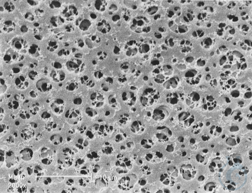 Celluloseacetat Membranfilter / Typ 11106