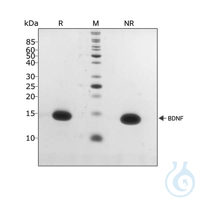 Recombinant human BDNF protein 0.01mg Free delivery on RUO growth factors and...