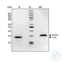 Recomb human HGF (NK1) protein 0.1mg Free delivery on RUO growth factors and...