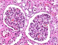 Formaldehydl&ouml;sung 4% gepuffert (pH 6,9), f&uuml;r die Histologie Inhalt pro...