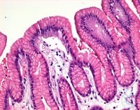 H&auml;matoxylin-Monohydrat (C.I.75290) f&uuml;r die Mikroskopie Certistain&reg; Inhalt pro...