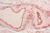Orcein kit 100 Tests BioGnost BioGnost ready to use kit for special stain. Five-reagent kit for...