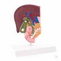 Anatomisches Modell der Gallenblase mit ihren Erkrankungen Anatomisches...