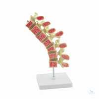 Osteoporose-Modell «Wirbelsäule» Osteoporose-Modell «Wirbelsäule»