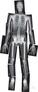 Röntgenbilder Mensch Röntgenbilder Mensch