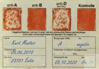 Blutgruppenbestimmung mit Trockentestseren für ABO und Rho (D), pack mit 10...