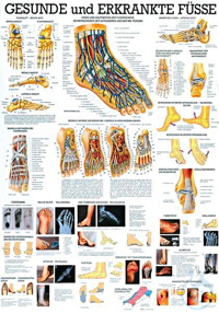 anat. Lehrtafel: Gesunde und erkrankte Füße 70 x 100 cm, laminiert anat....