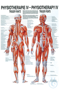 anat. Poster: Physiotherapie Triggerpunkte, 50 x 70 cm, Papier zweisprachig...