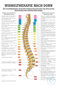 anat. Mini-Poster: Dorn Therapie 24 x 34 cm, laminiert anat. Mini-Poster:...