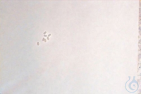 PVDF-Doppelkonen für Kapillaranschluss 1/16? mit Rändelschraube  VE=10 Unit...