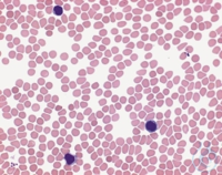 May-Grünwalds EosinMethylenblaulösung modifiziert für   die Mikroskopie...