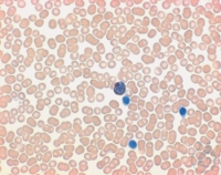 Titriplex® III-Lösung for 1000 ml. c(Na2-EDTA 2 H2O) = 0.01 mol/l Titrisol®...