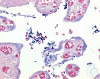 Lugols Lösung (verdünnte IodKaliumiodidlösung) für die GramFärbung  VE=1 l...