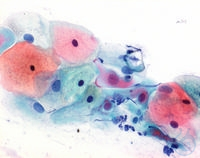 Papanicolaous Lösung 3b Polychromlösung EA 50  VE=2.5 l Papanicolaous Lösung...