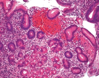 Mayers Hämalaunlösung für die Mikroskopie  VE=2.5 l Mayers Hämalaunlösung für...