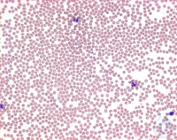 Wrights Eosin-Methylenblau für die  Mikroskopie  VE=25 g Wrights...